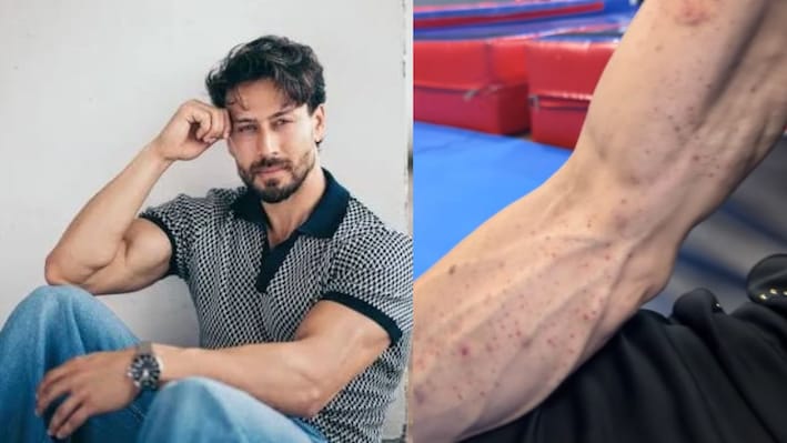 Tiger Shroff's mother Ayesha shares a video of his son's arms with burn marks