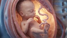 What is a heterotopic pregnancy? 32-year-old woman's diagnosis highlights hidden risk