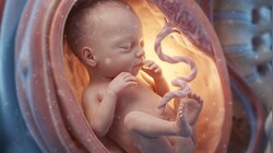 What is a heterotopic pregnancy? 32-year-old woman's diagnosis highlights hidden risk
